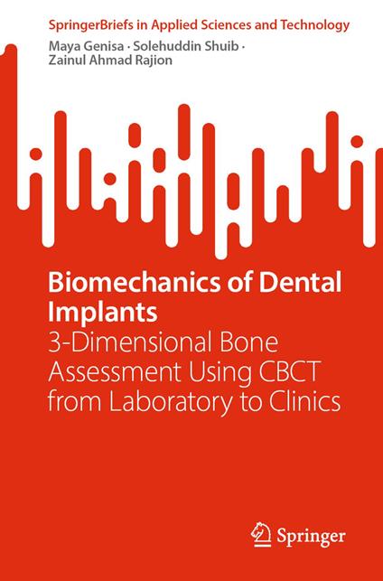 Biomechanics of Dental Implants