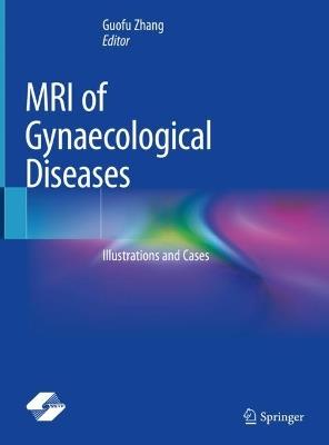 MRI of Gynaecological Diseases: Illustrations and Cases - cover
