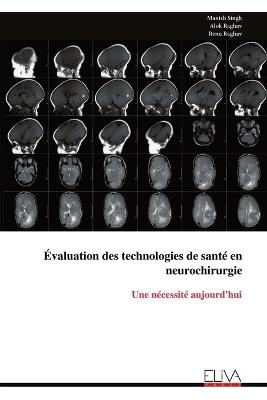 Évaluation des technologies de santé en neurochirurgie: Une nécessité aujourd'hui - Manish Singh - cover