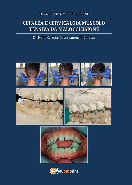 Cefalea e cervicalgia muscolo tensiva da malocclusione - Ivano Carotta,Antonella Carotta - copertina