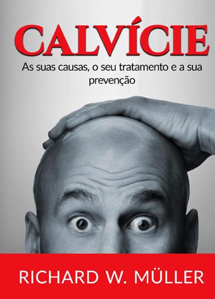 Calvície. As suas causas, o seu tratamento e a sua prevenção - Richard W. Müller - copertina