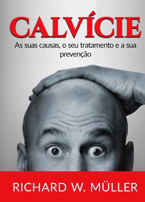 Calvície. As suas causas, o seu tratamento e a sua prevenção - Richard W. Müller - copertina