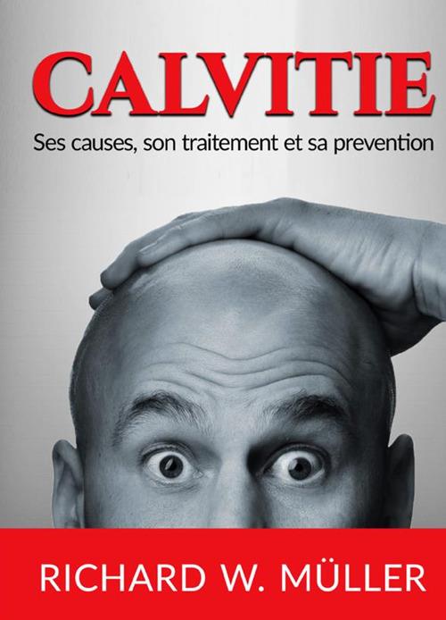 Calvitie. Ses causes, son traitement et sa prevention - Richard W. Müller - copertina