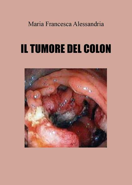 Il tumore del colon - Maria Francesca Alessandria - copertina