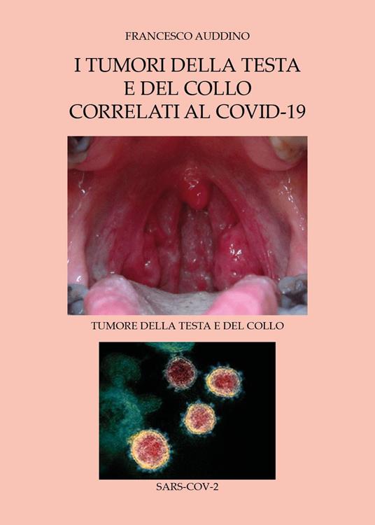 I tumori della testa e del collo correlati al Covid-19 - Francesco Auddino - copertina