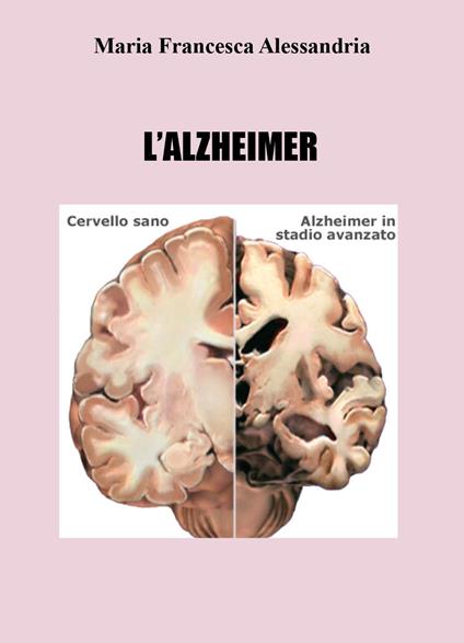 L'azheimer - Maria Francesca Alessandria - copertina