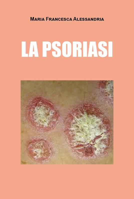 La psoriasi - Maria Francesca Alessandria - copertina