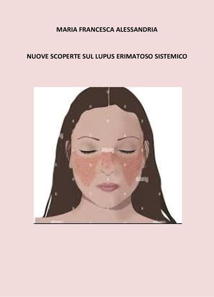 Nuove scoperte sul lupus erimatoso sistemico - Maria Francesca Alessandria - copertina
