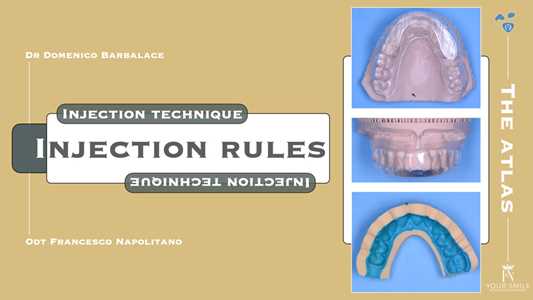 Libro Injection Rules. injection technique. Ediz. multilingue Domenico Barbalace