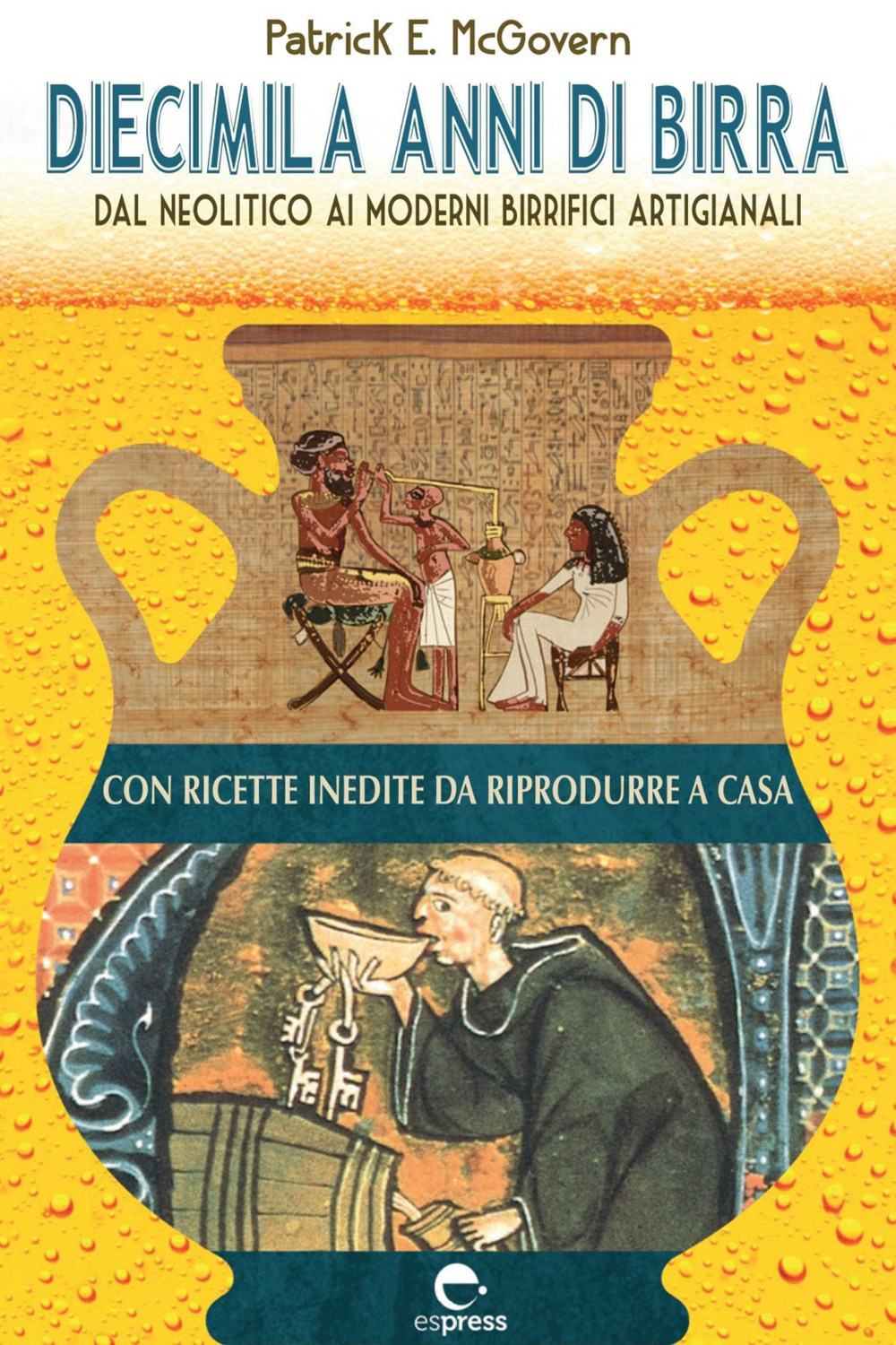 ibs