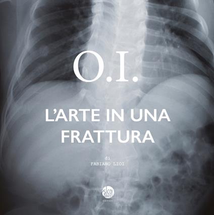 O.I. L'arte in una frattura - Fabiano Lioi - copertina