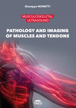 Musculoskeletal ultrasound. Pathology and imaging of muscles and tendons. Ediz. illustrata