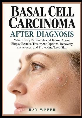 Basal Cell Carcinoma After Diagnosis: What Every Patient Should Know About Biopsy Results, Treatment Options, Recovery, Recurrence, and Protecting Their Skin - Ray Weber - cover