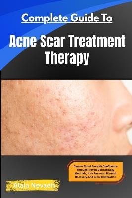 Complete Guide To Acne Scar Treatment Therapy: Clearer Skin & Smooth Confidence Through Proven Dermatology Methods, Pore Renewal, Blemish Recovery, And Glow Restoration - Alaia Nevaeh - cover