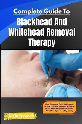 Complete Guide To Blackhead And Whitehead Removal Therapy: Clear Congested Pores And Smooth Uneven Texture For Refined, Balanced Skin Deep Cleanse Safe Extraction, Prevention Tips For Lasting Clarity - Alaia Nevaeh - cover