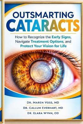Outsmarting Cataracts: How to Recognize the Early Signs, Navigate Treatment Options, and Protect Your Vision for Life - Callum Everhart,Elara Wynn Od,Maren Voss - cover