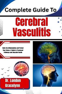 Complete Guide To Cerebral Vasculitis: Calm the Inflammation and Protect Your Future: A Guide to Treatment Pathways and Vascular Health - London Gracelynn - cover