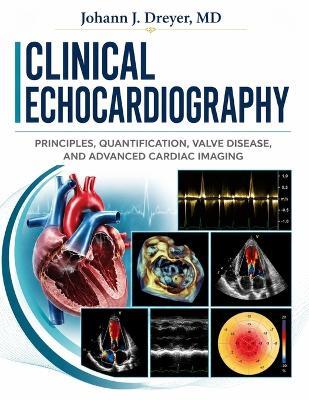 Clinical Echocardiography: Principles, Quantification, Valve Disease, and Advanced Cardiac Imaging - Johann J Dreyer - cover