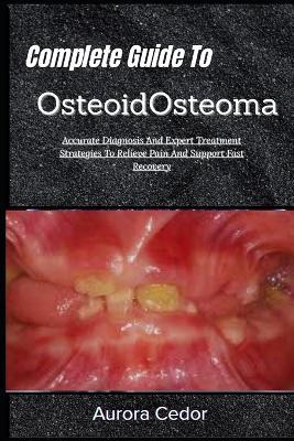 Complete Guide To OsteoidOsteoma: Accurate Diagnosis And Expert Treatment Strategies To Relieve Pain And Support Fast Recovery - Aurora Cedor - cover