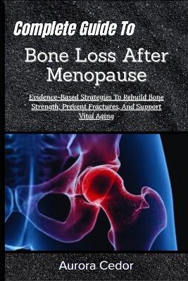 Complete Guide To Bone Loss After Menopause: Evidence-Based Strategies To Rebuild Bone Strength, Prevent Fractures, And Support Vital Aging - Aurora Cedor - cover