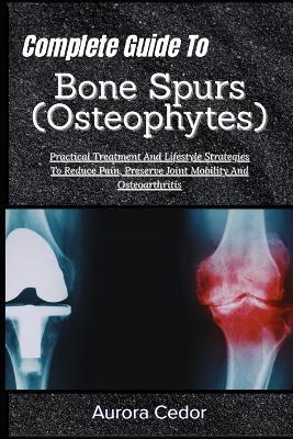 Complete Guide To Bone Spurs (Osteophytes): Practical Treatment And Lifestyle Strategies To Reduce Pain, Preserve Joint Mobility And Osteoarthritis - Aurora Cedor - cover