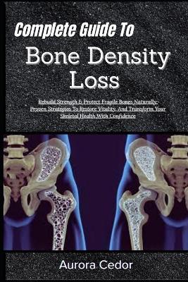 Complete Guide To Bone Density Loss: Rebuild Strength & Protect Fragile Bones Naturally: Proven Strategies To Restore Vitality, And Transform Your Skeletal Health With Confidence - Aurora Cedor - cover