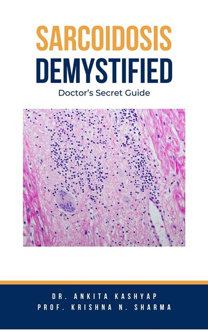 Sarcoidosis Demystified: Doctor's Secret Guide