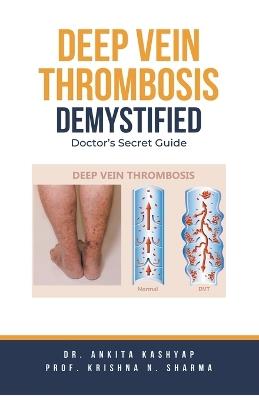 Deep Vein Thrombosis Demystified: Doctor's Secret Guide - Ankita Kashyap,Prof Krishna N Sharma,Krishna N Sharma - cover