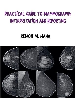 Practical Guide to Mammography Interpretation and Reporting - Remon M Hana - cover