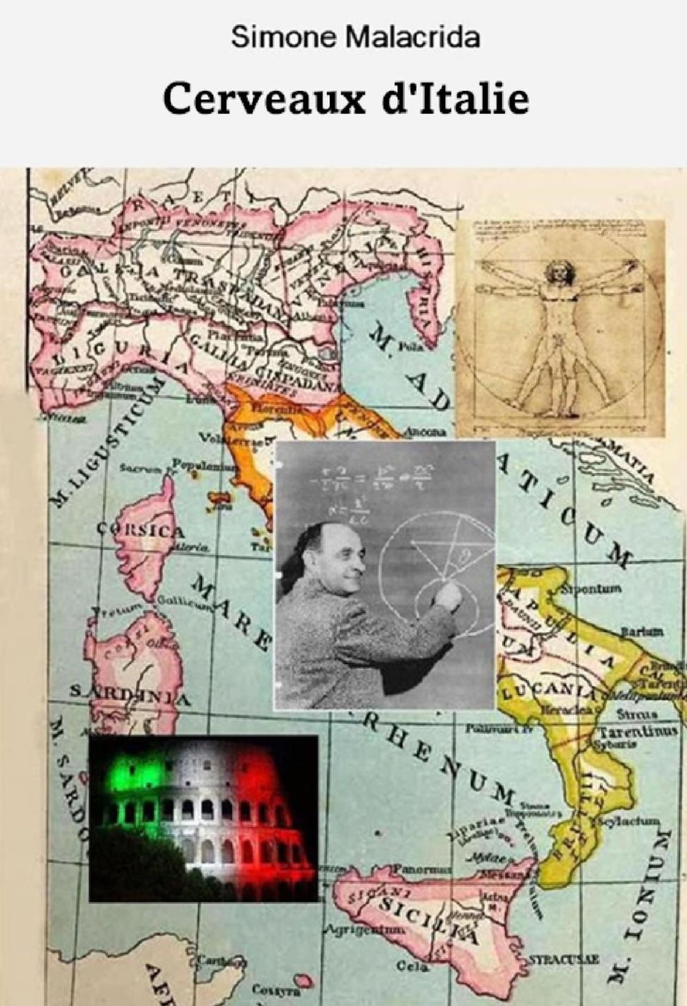 ibs