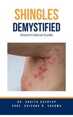 Shingles Demystified: Doctor’s Secret Guide