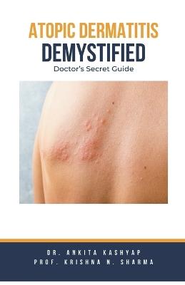 Atopic Dermatitis Demystified: Doctor's Secret Guide - Ankita Kashyap,Prof Krishna N Sharma,Krishna N Sharma - cover