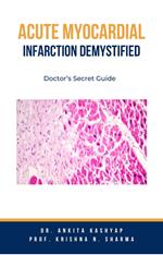Acute Myocardial Infarction Demystified: Doctor’s Secret Guide