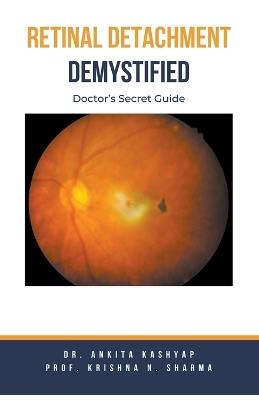 Retinal Detachment Demystified: Doctor's Secret Guide - Ankita Kashyap,Prof Krishna N Sharma,Krishna N Sharma - cover