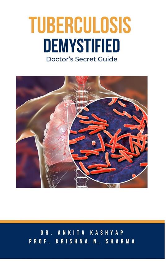 Tuberculosis Demystified: Doctor's Secret Guide
