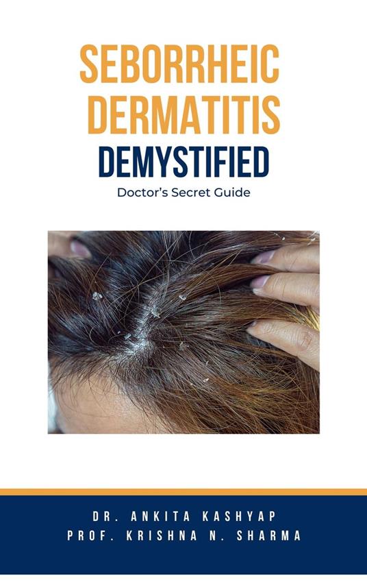 Seborrheic Dermatitis Demystified: Doctor's Secret Guide