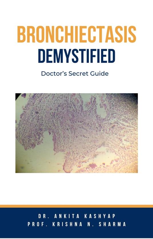 Bronchiectasis Demystified: Doctor’s Secret Guide
