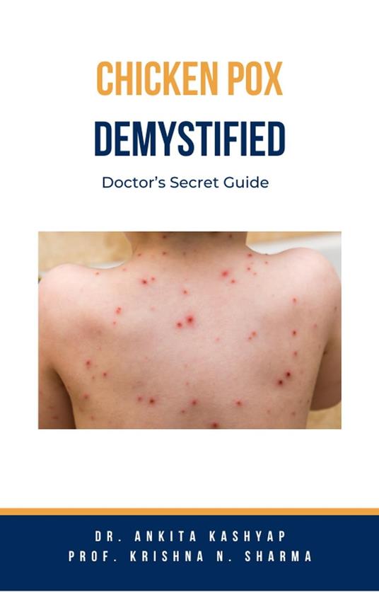 Chickenpox Demystified: Doctor’s Secret Guide