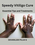 Speedy Vitiligo Cure: Essential Tips and Treatments