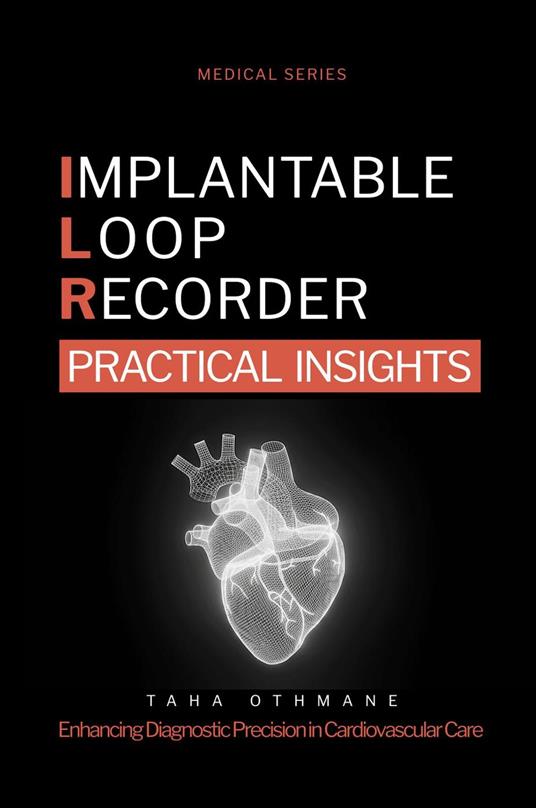 Implantable Loop Recorder: Practical Insights