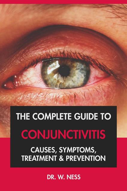 The Complete Guide to Conjunctivitis: Causes, Symptoms, Treatment & Prevention