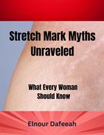 Stretch Marks Unraveled: What Every Woman Should Know