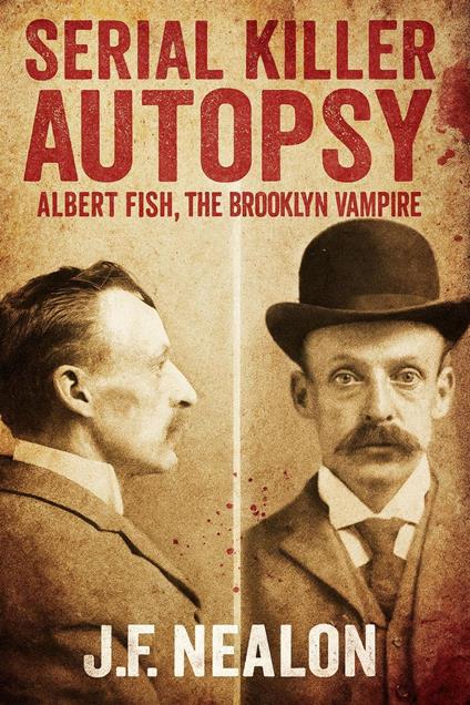 Serial Killer Autopsy: Albert Fish, The Brooklyn Vampire