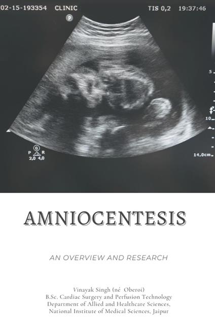 Amniocentesis: An Overview and Research