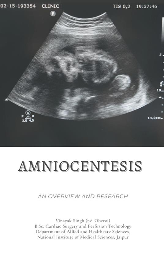 Amniocentesis: An Overview and Research
