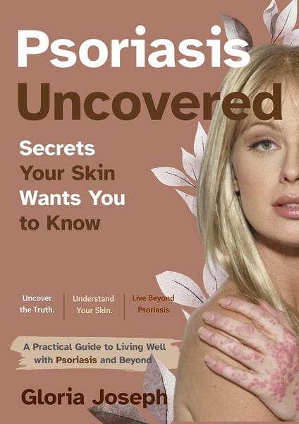 Psoriasis Uncovered