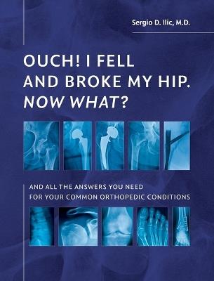 Ouch! I Fell and Broke My Hip. Now What?: And All the Answers You Need for Your Common Orthopedic Conditions - Sergio D ILIC - cover