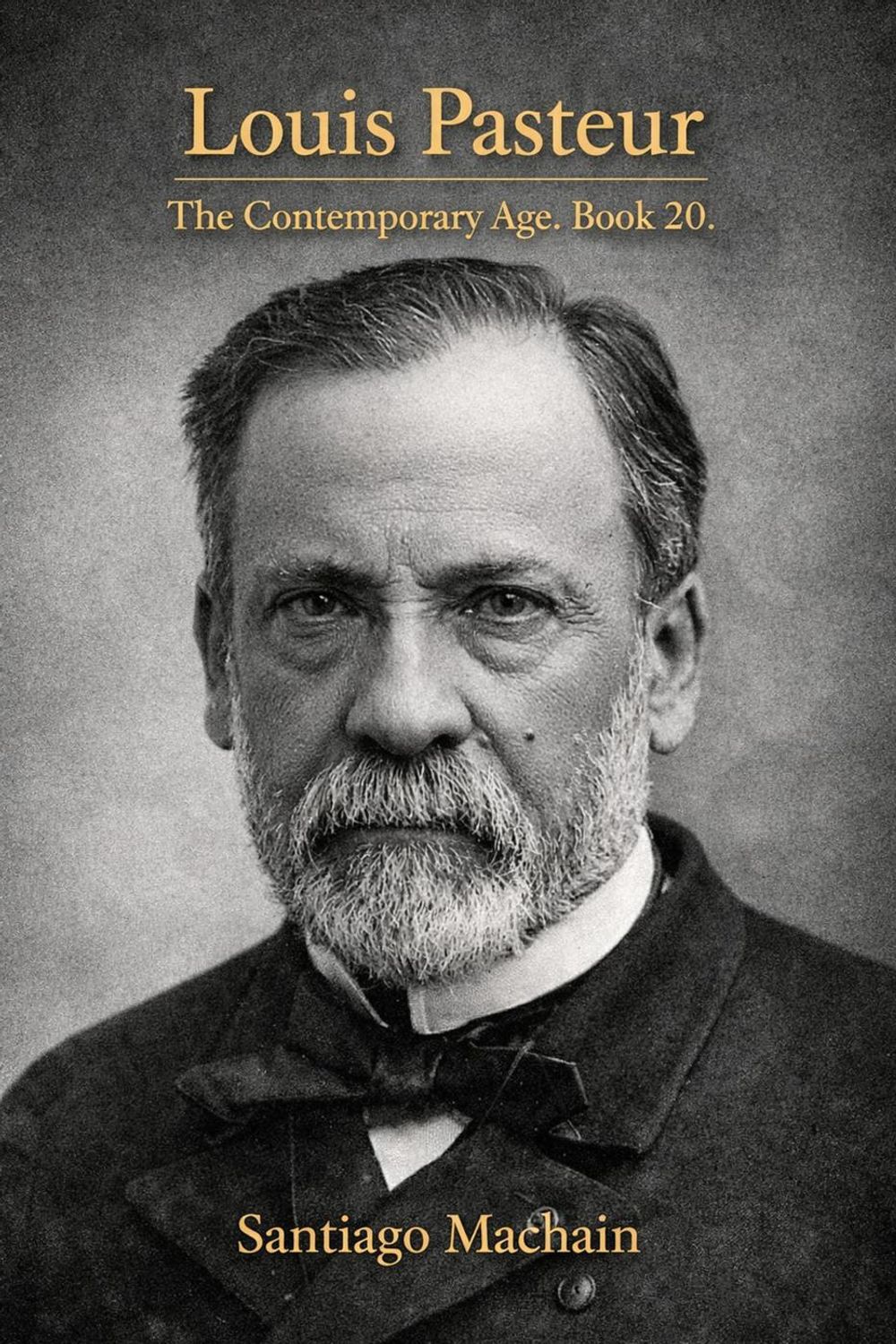 ibs