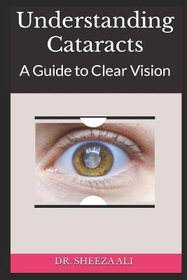 Understanding Cataracts: A Guide to Clear Vision - Sheeza Ali - cover
