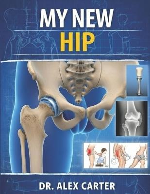 My New Hip: The Complete Guide to Hip Replacement Surgery, Recovery, Rehab, Pain Relief, Exercises, and Regaining Mobility - Alex Carter - cover